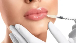 Dermal fillers in Tulum for lips, cheeks and facial contouring