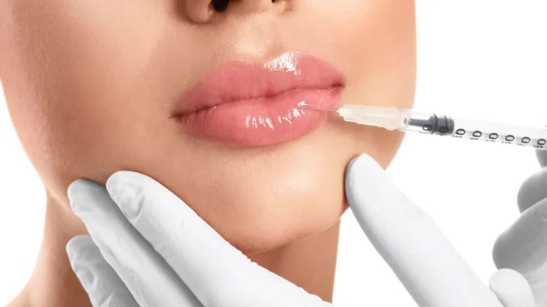 Dermal fillers in Tulum for lips, cheeks and facial contouring