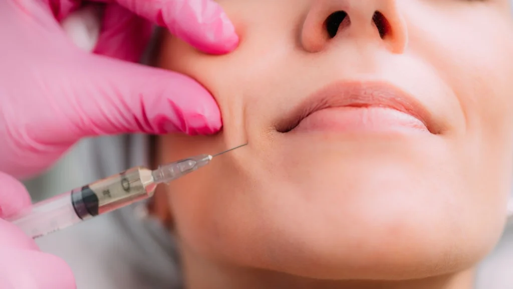Dermal fillers in Tulum for lips, cheeks and facial contouring