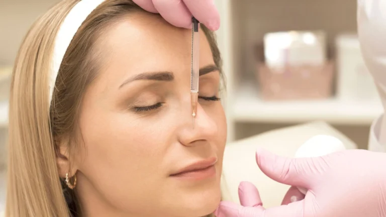 Non-surgical nose reshaping with dermal fillers in Tulum
